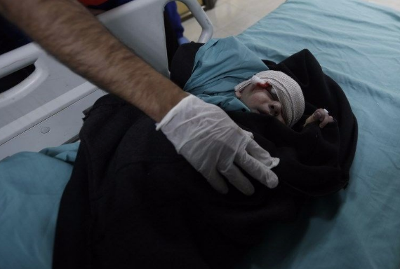 Korkunç bilanço! "Öfke Cuması"nda ölü ve yaralı sayısı açıklandı - Resim: 1