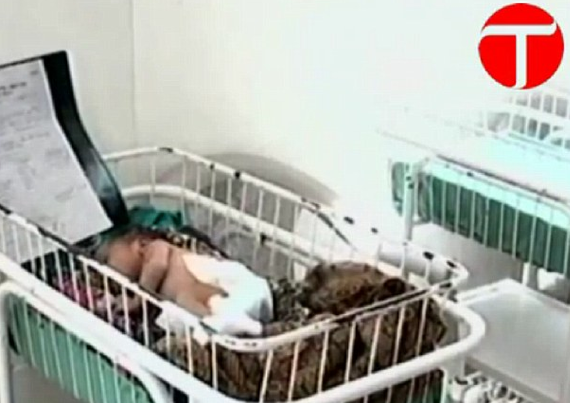 Aman Allah'ım! Şimdi de üç kollu bebek - Resim: 3