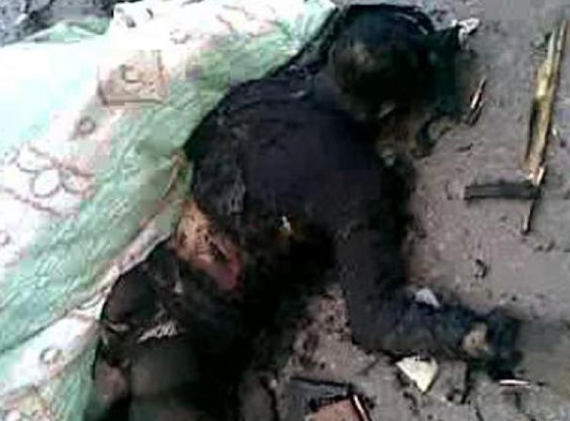 Savaşın kanlı yüzü bu görüntülerde! - Resim: 1