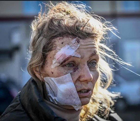 Rusya-Ukrayna savaşının simgesi oldu dünyanın konuştuğu yaralı kadın bakın ne dedi? - Resim: 1