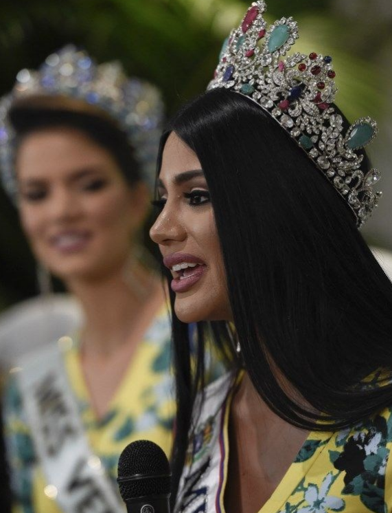 Venezuella Güzeli'nin eski hali görenleri şaşırttı - Resim: 4