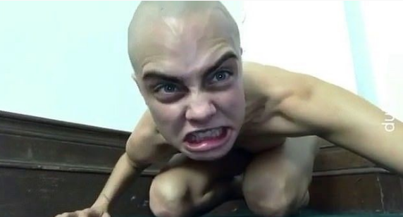 Ünlü oyuncu tanınmaz halde! Son hali şaşırttı - Resim: 4