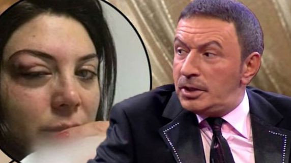 Mustafa Topaloğlu'nun eşinden kötü haber geldi! Duyanlar hastaneye koştu! - Resim: 3