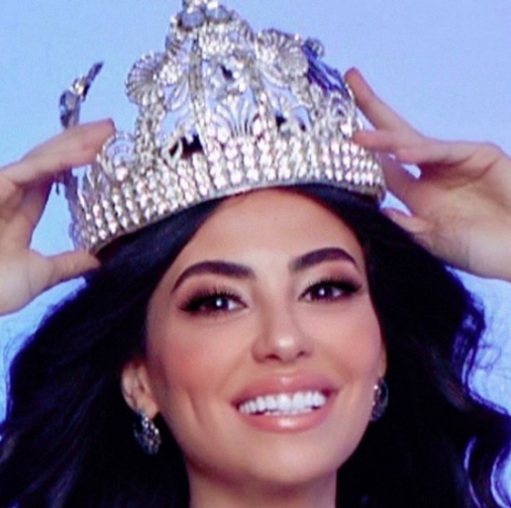 Dünyanın en iyi modelinin mesleği şaşırtacak! - Resim: 1