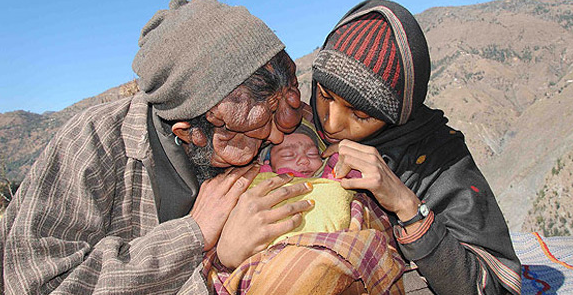 Yüzü olmayan adamın mucize bebeği - Resim: 1