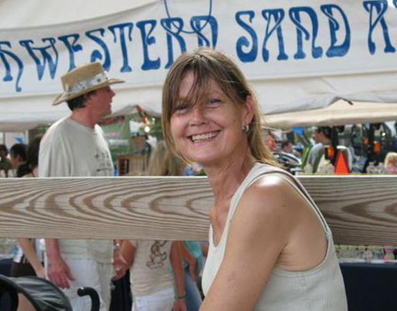 Şempanzenin parçaladığı kadına tam yüz nakli - Resim: 4