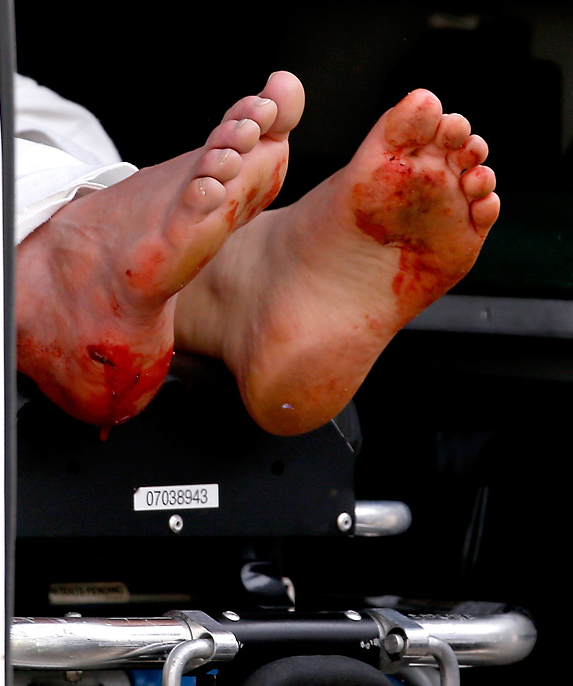 Boston patlamasından şok kareler - Resim: 2