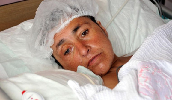 Bakımsızlıktan vücudu kurtlandı! - Resim: 1