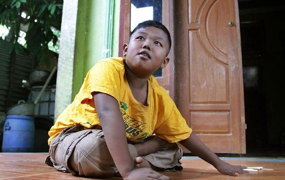 2 yaşında dünyayı şoke etmişti yeni hali çok başka - Resim: 4