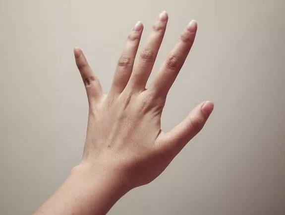 Parmaklarınıza bakın ve hemen bu testi yapın! Kanser olabilirsiniz - Resim: 0