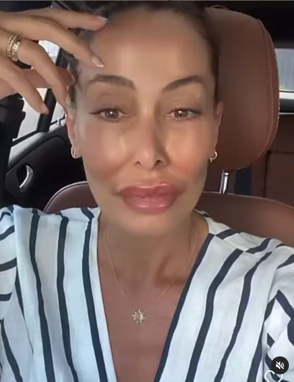 Melek Baykal'dan estetik ve dolgu dudak videosu! Serap Paköz çok kızacak! - Resim: 4