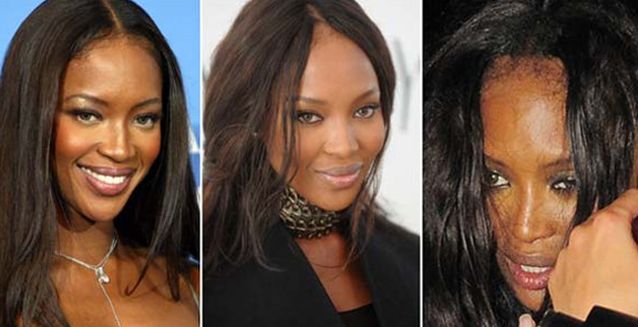 Bu ünlüler kelliğin eşiğinde - Resim: 4