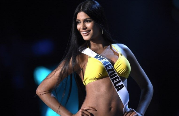 Venezuella Güzeli'nin eski hali görenleri şaşırttı - Resim: 1