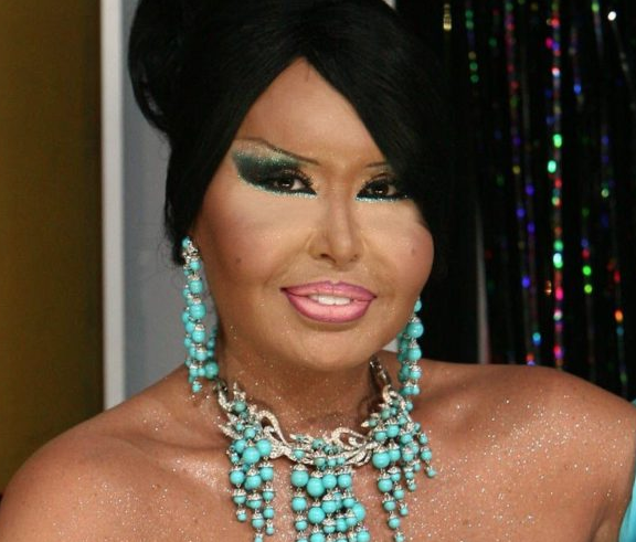 Bülent Ersoy: Arda'nın üzerine çok gidiliyor - Resim: 2