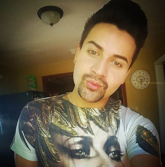 Madonna'ya benzemek istedi defalarca ameliyat oldu - Resim: 3