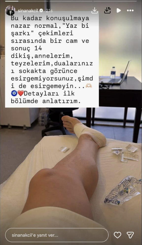 Sinan Akçıl sevenlerini korkuttu! Sette kaza geçirdi: 14 dikiş atıldı... - Resim: 5