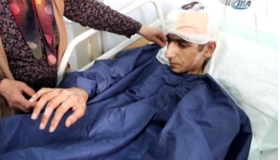 Liseli Onur cayır cayır yandı - Resim: 3