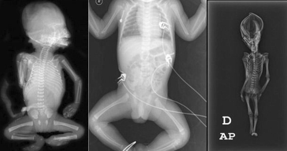 Uzaylı mumyası olduğu iddia edilmiş! Tüm sır çözüldü - Resim: 4