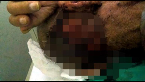 Kafasında kurtçukların türediği adam için harekete geçildi - Resim: 1