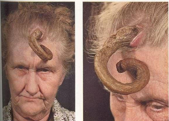 Dünyanın en garip hastalıkları - Resim: 1