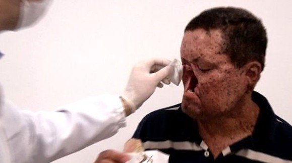 Bu köydeki herkes güneş görünce eriyor! - Resim: 3