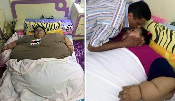 Dünyanın en kilolu kadını 25 yıl sonra dışarı çıktı - Resim: 3