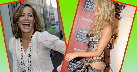 Ünlülerde rezil olur! - Resim: 1