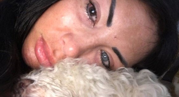 Göz  rengini değiştirmek isterken kör oldu - Resim: 3