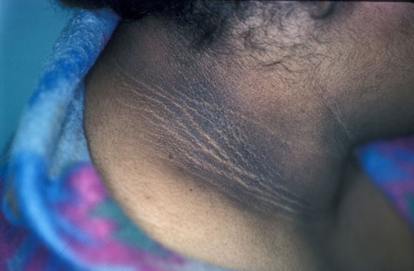 Annesi kir sandı ama hastalık çıktı! - Resim: 4