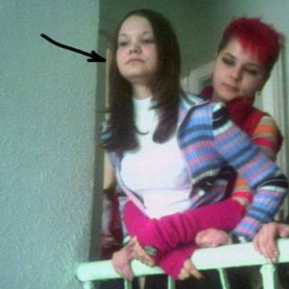 Onun yeni hali görenleri dehşete düşürüyor - Resim: 1