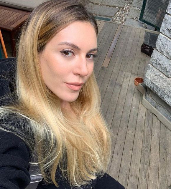 2 ay önce doğum yapan Sinem Kobal'ın son hali sosyal medyayı ayağa kaldırdı! - Resim: 2