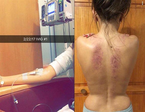 Kimse dediklerine inanmadı daha sonra vücudu bu hale geldi - Resim: 1