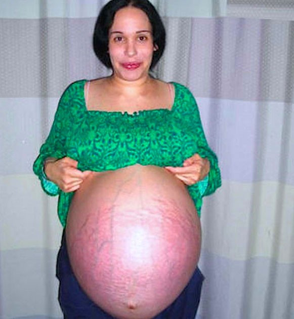 Aynı anda 8 bebek dünyaya getirdi gerçek daha sonra çıktı! - Resim: 2