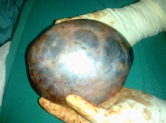 6 aylık hamile kadından çıkana bakın - Resim: 1