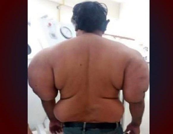 Denize girdi bu hale geldi görenler şoke oluyor! - Resim: 1