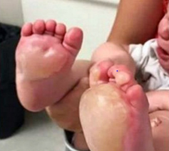 Bebeklerinin ayakları bu hale geldi gerçeği öğrenince işler değişti - Resim: 1