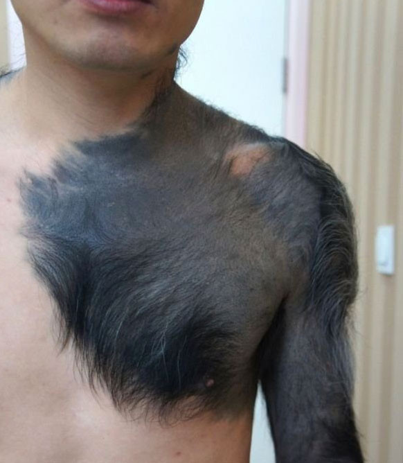 Vücudu görenleri dehşete düşürdü - Resim: 4