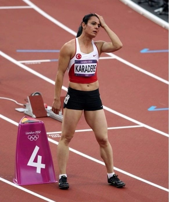 Survivor Nagihan Karadere estetikle bambaşka biri haline geldi gören tanımadı - Resim: 4