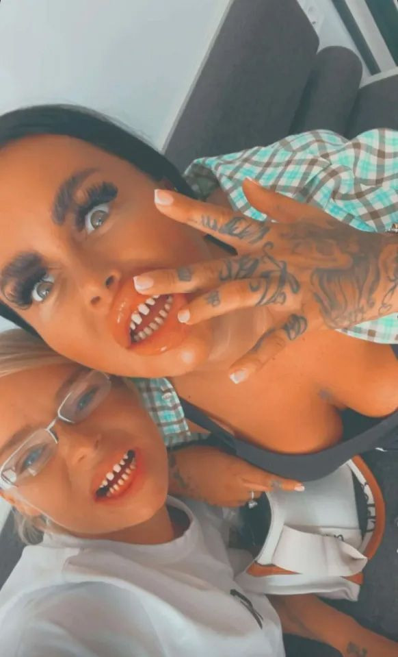 Antalya'ya diş estetiği yaptırmaya geldiler hayatları karardı! Ağızlarına koyamıyorlar... - Resim: 3