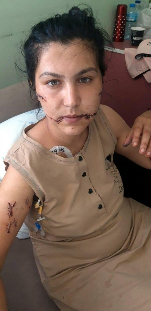 İzmir'de vahşet! Dini nikahlı eşini 104 yerinden bıçaklayıp ölmesini beklemiş! - Resim: 3