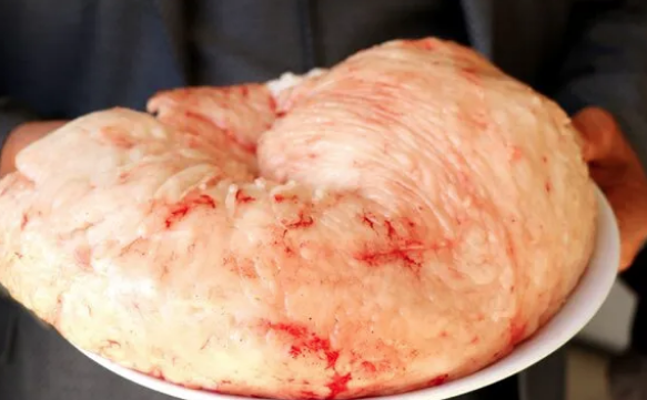 Canan Karatay yiyen 95 yaşına kadar yaşıyor dedi! Fiyatı yüzde 100 zamlandı - Resim: 3