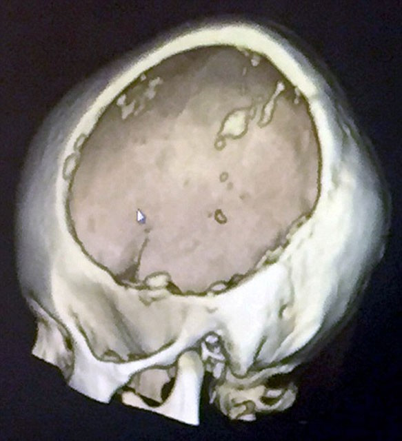 Dikkat! Doğum kontrol hapı kullandı hayatının kabusunu yaşadı - Resim: 3
