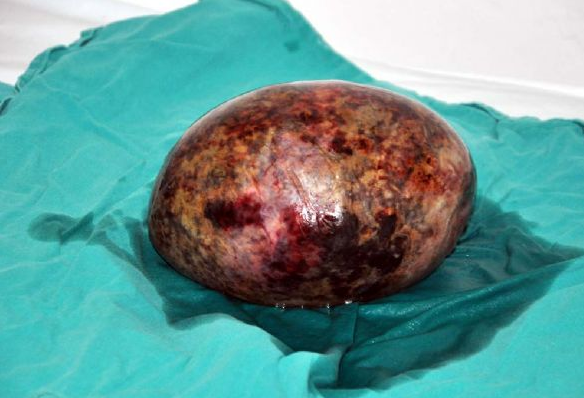 Karnından çıkanı görence şaşkına döndü! - Resim: 1