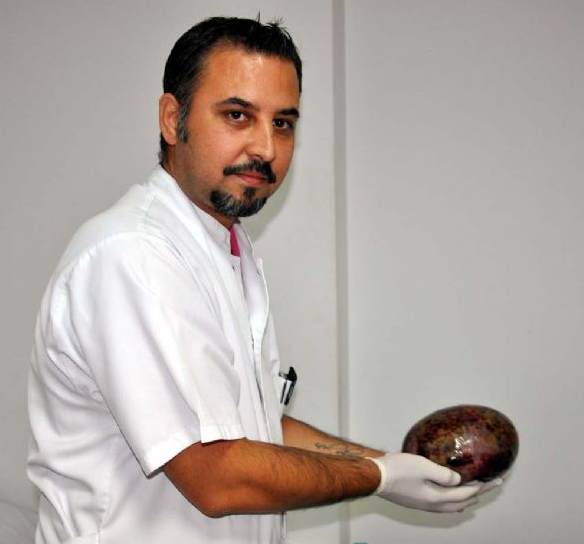 Karnından çıkanı görence şaşkına döndü! - Resim: 2