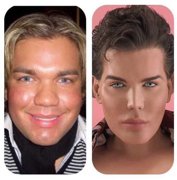 Estetik operasyonlar Barbie adamı bu hale getirdi - Resim: 1