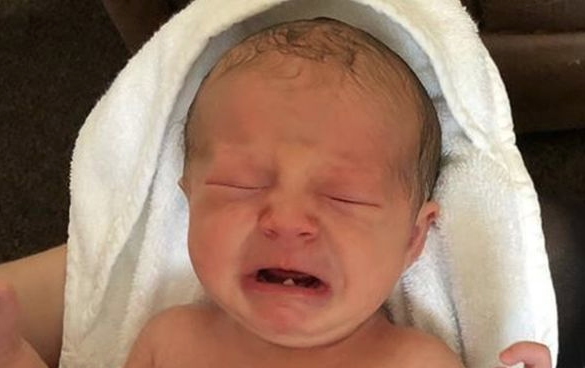 Sonunda bu da oldu! 12 günlük bebek diş çektirdi - Resim: 1