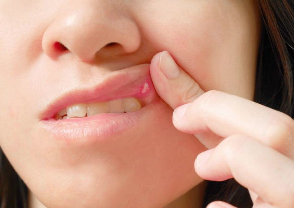 Herkeste görülüyor ama umursanmıyor! Eğer bu şekildeyse kanser ediyor - Resim: 1