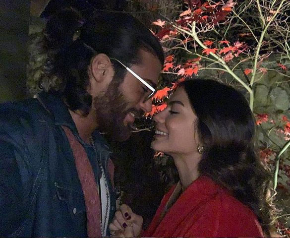 Erkenci Kuş'un Can Yaman'ı neden gözlük takıyor hastalığı ne? - Resim: 2