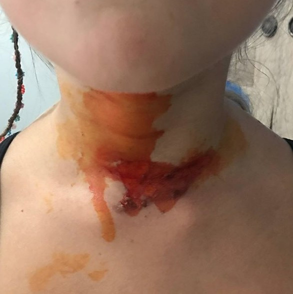 Yeliz Yeşilmen kızını reklam için mi yaktı şok iddia - Resim: 4