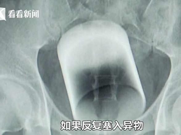 Makatından bardak çıktı akıllara zarar olaya herkes şaştı kaldı - Resim: 2